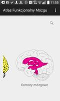 Atlas Funkcjonalny Mózgu syot layar 3