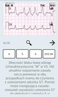 Ekg ratunkowe 截图 1