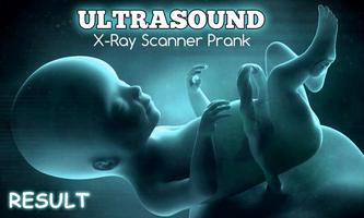 Ultrasound Scanner – xray scanner prank capture d'écran 3