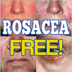 Rosacea Free Forever!