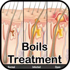Boils Symptoms Treatment APK 下載