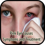 Pink Eye Causes Symptoms