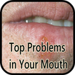 Top Problems in Your Mouth