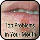 Top Problems in Your Mouth APK