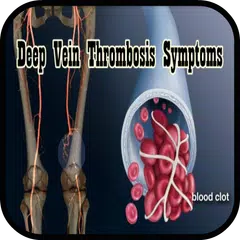 Descargar APK de Deep Vein Thrombosis Symptoms