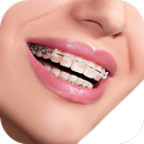 Real Braces Camera APK