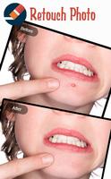 pixel retouch - remove unwanted content in photos Plakat