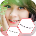 Braces Booth Photo Editor