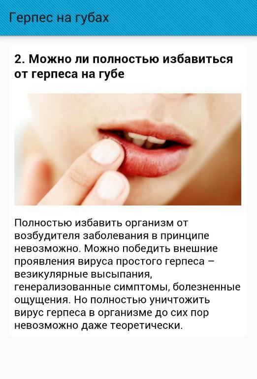 Эффективное лечение герпеса на губах препараты. Начальные проявления герпеса на губах. Простудный герпес на губах. Язвочки на губе герпес.
