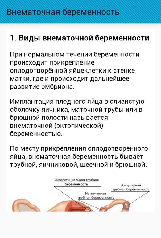 Внематочная как определить на ранних сроках. Внематочная беременность симптомы на ранних. Внематочная беременность симптомы. Симптомы вне внематочной беременности. Клиника внематочной беременности на раннем сроке.
