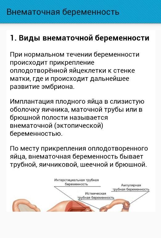 Внематочная беременность симптомы признаки на раннем сроке. Внематочная беременность симптомы на ранних. Внематочная беременность симптомы. Симптомы вне внематочной беременности. Клиника внематочной беременности на раннем сроке.