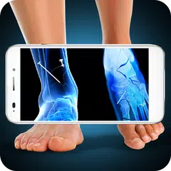 Xray Fracture Foot Prank APK download