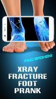 Xray Fracture Foot Prank captura de pantalla 2