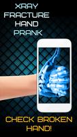 X Ray Fracture Main Prank Affiche
