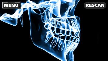 Xray Scanner Teeth Prank تصوير الشاشة 1