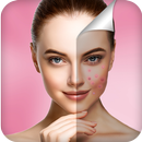 Pimple Remover: Photo Edit APK