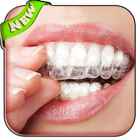 ikon teeth whitening secrets tips