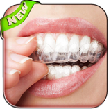 ikon teeth whitening secrets tips