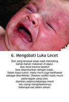 Tips Pengobatan Anak imagem de tela 2