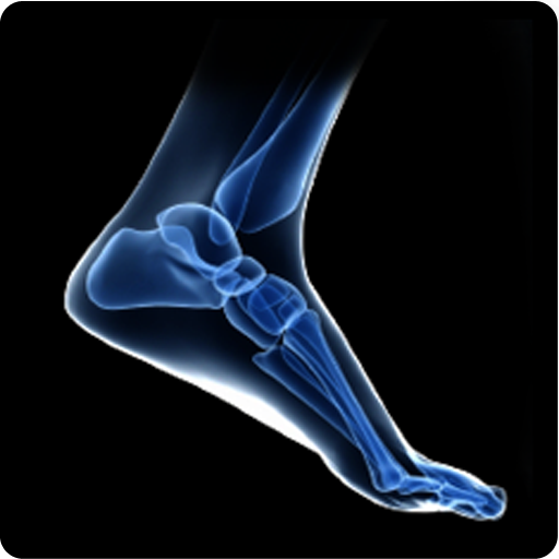 JMD Joint Motion Detector