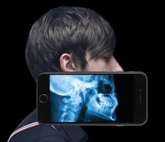 X-Ray body scan (prank) ภาพหน้าจอ 2