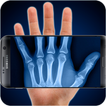 Scan with X-ray (simulation)