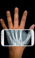 Xray Scanner syot layar 3