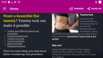Tummy Tuck (Abdominoplasty) ポスター
