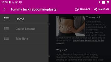 Tummy Tuck (Abdominoplasty) capture d'écran 1