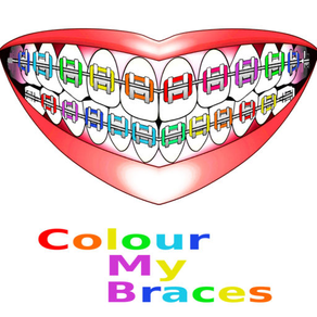 Colour My Braces