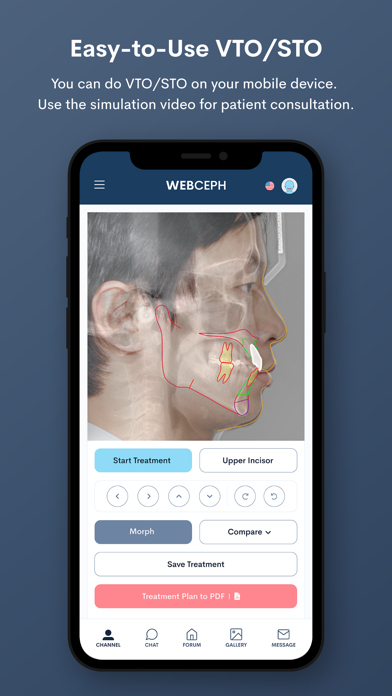 WebCeph poster