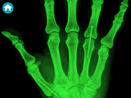 X-Ray Scanner Simulator Prank poster