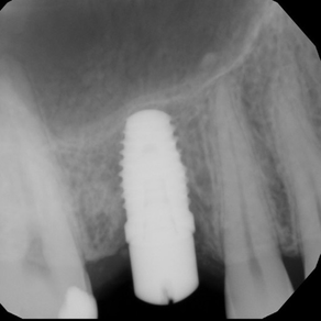 Dental ML