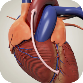 CABG Risk