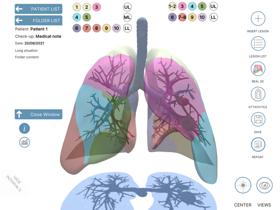 LUNG-NOTE poster