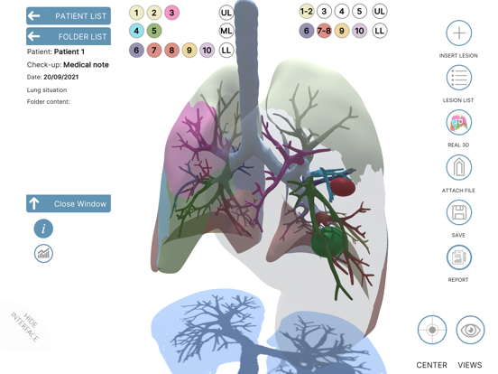 LUNG-NOTE poster