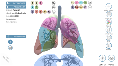 LUNG-NOTE poster