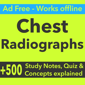 Chest Radiographs Exam Prep