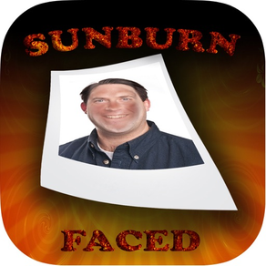 SunburnFaced - Fake Sun Tan FX