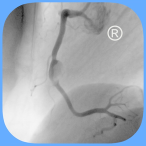 CARDIO3®Invasive Cardiology HD