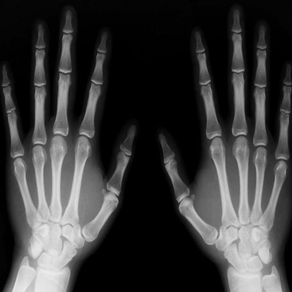 Radiography Glossary and Flashcard,Study Guide
