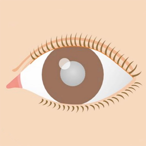 図解「白内障」イラストで見る眼疾患説明シリーズ