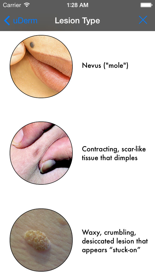 uDerm poster