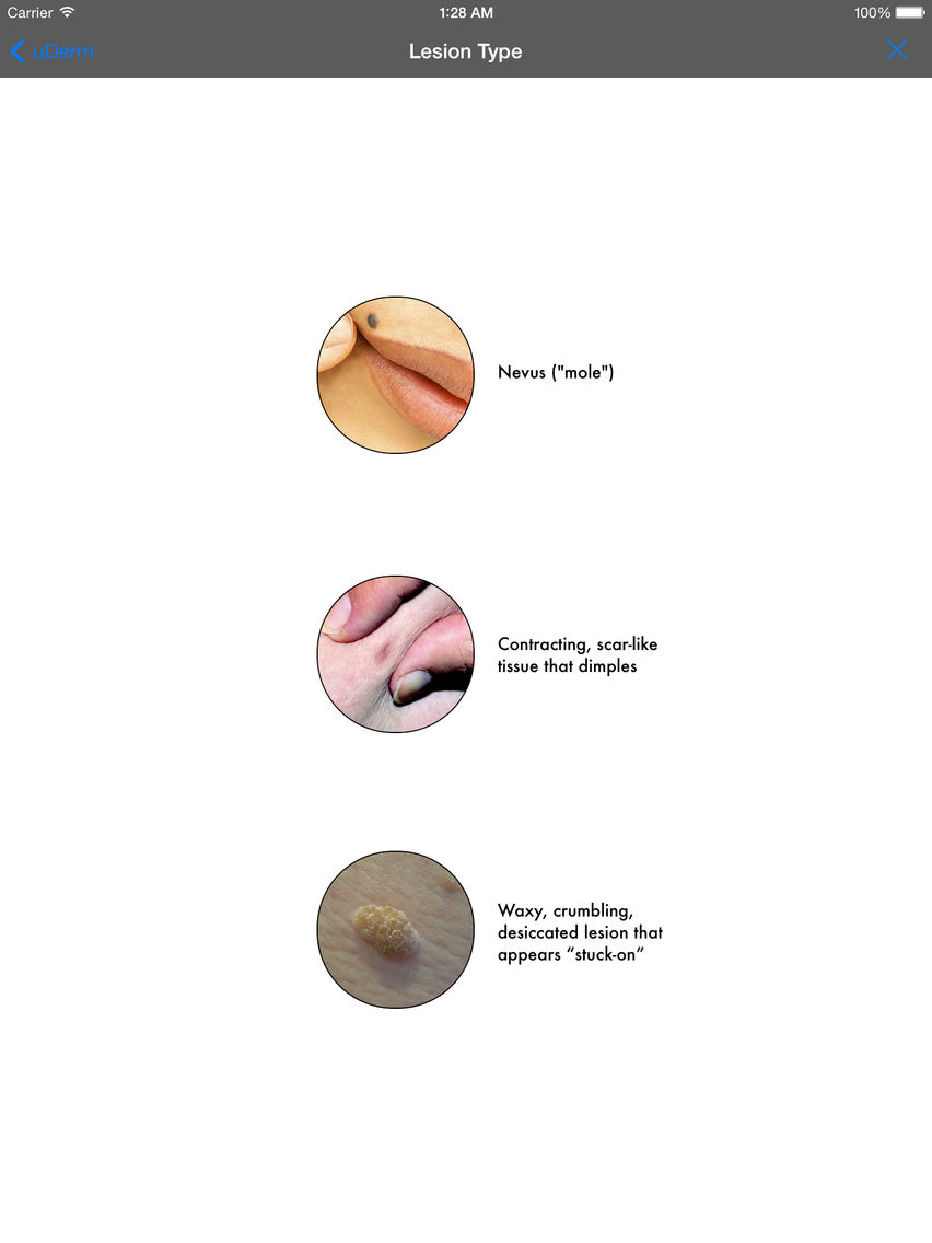 uDerm poster