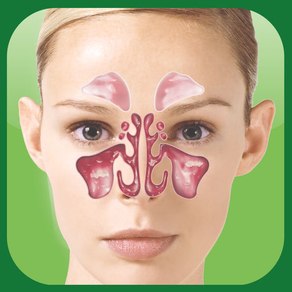 Sinus Allergy Pro™