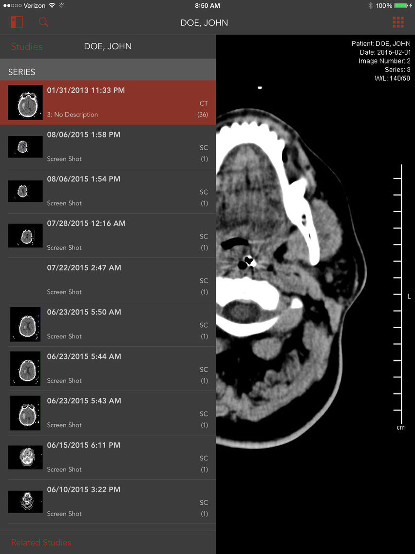 Pacs viewer ios iphone ipad apppure