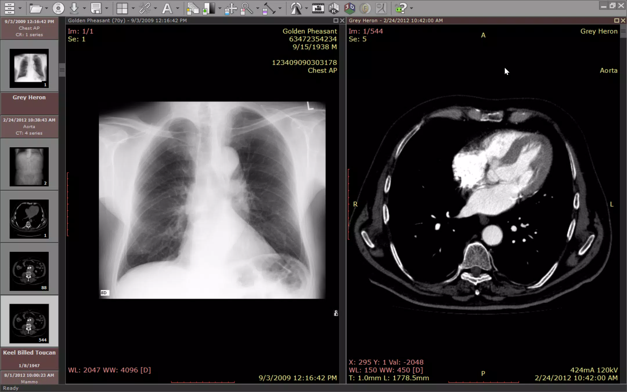 RadiAnt DICOM Viewer