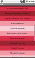 Electrocardiograma ECG Tipos captura de pantalla 1