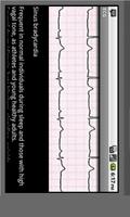 برنامه‌نما Electrocardiogram ECG Types عکس از صفحه