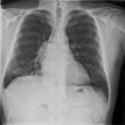 ikon Radiologia en preguntas cortas